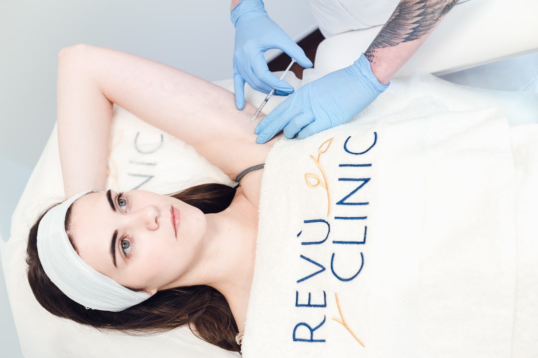 REVU CLINIC padidejusio prakaitavimo gydymas REVU CLINIC padidejusio prakaitavimo gydymas